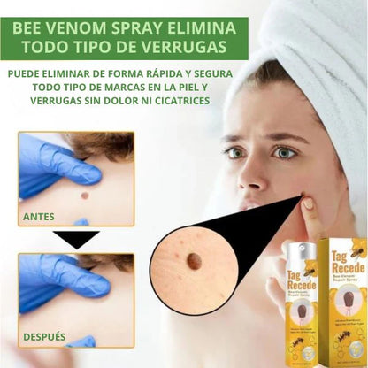 BeeFree™ Despídete de verrugas y lunares en 5 días - Bee Venom Spray®