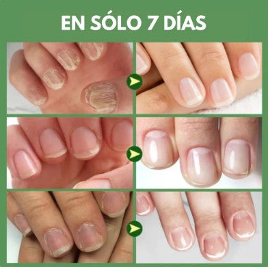 Uñas fuertes y saludables en solo 7 días / Combo bases endurecedora de uña de titanio X3